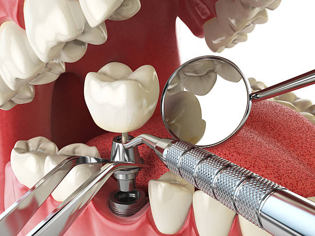 Best Emergency Dental Care for Sports Injuries in Dennison, OH